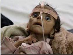http://www.informationclearinghouse.info/yemen-child-starving-a.JPG